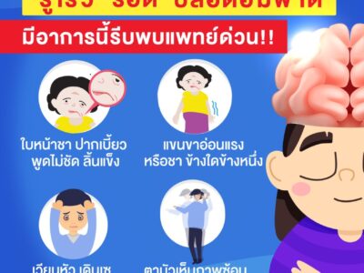 Read more about the article สโตรค โรคหลอดเลือดสมอง” มีอาการนี้ พบแพทย์ด่วน รู้เร็ว รอด ปลอดอัมพาต