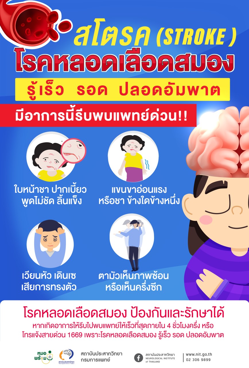 Read more about the article สโตรค โรคหลอดเลือดสมอง” มีอาการนี้ พบแพทย์ด่วน รู้เร็ว รอด ปลอดอัมพาต